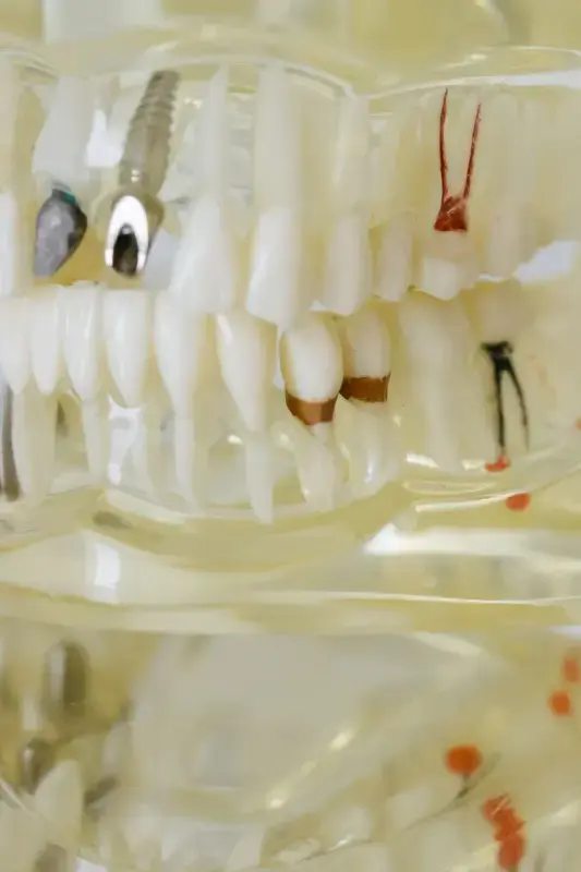 Restorative Dentistry